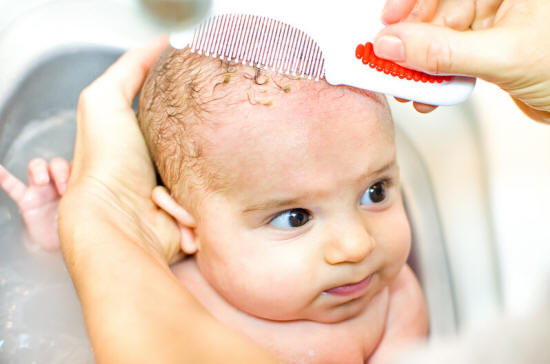 Cradle cap is a normal and common skin condition for newborns
