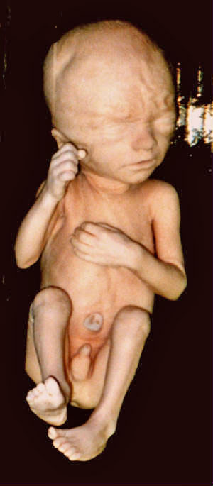 fetus02b.jpg